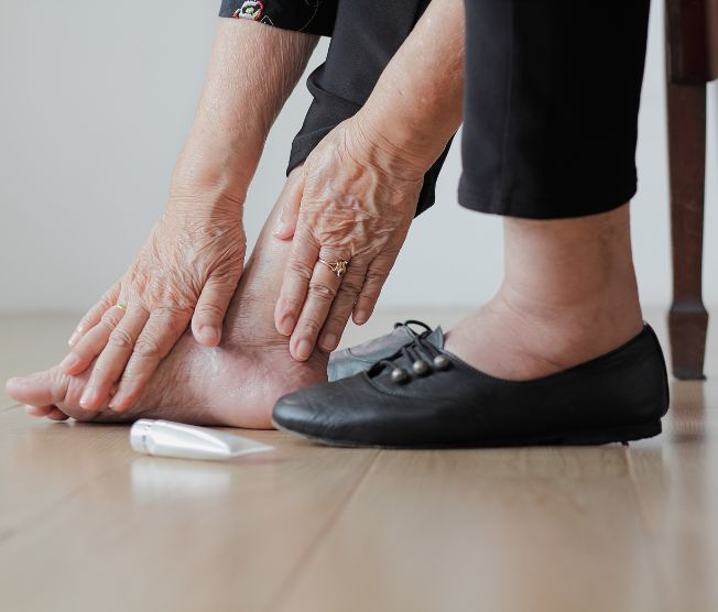 Frequent Ankle Swelling: Move More and Seek Evaluation